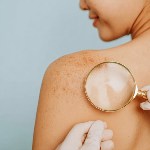 skincare during cancer treatment, safe skincare for chemotherapy, gentle skincare sensitive skin, non-toxic skincare acne, clean skincare acne